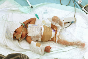 Carrefour  Haiti  krankes Kleinkind in der Intensivstation des Field Hospitals