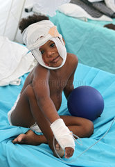 Carrefour  Haiti  ein Kind mit Brandverletzung im Patientenzelt