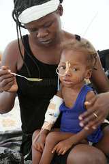 Carrefour  Haiti  im Patientenzelt fuettert eine Mutter ihre kranke Tochter