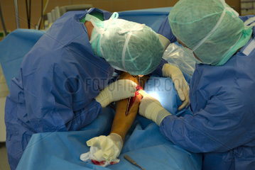 Chirurg entfernt Titan-Platte aus Unterschenkel