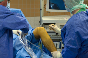 Chirurg schneidet Knie fuer Kniespiegelung