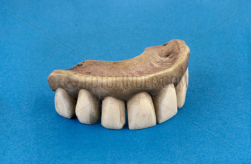 Partial upper denture  mid 19th century.