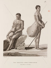 Tubercular leprosy sufferers  Mariana Islands  1817-1820.