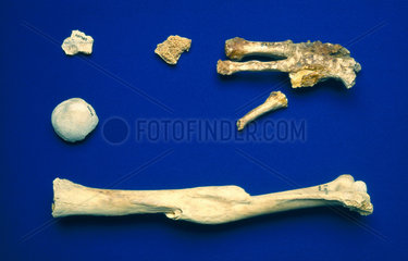 Humerus of an adult human  and broken foot bones  Egyptian  4000 BC- AD 200.