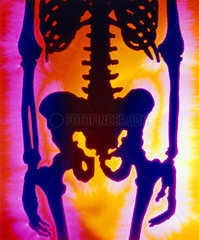 Kirlian photograph of a human skeleton.