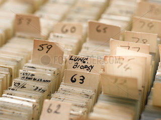 Lung tissue slides in Dr P C Elmes' slide cabinet  1958-1976.