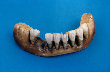 Full lower denture  1801-1860.
