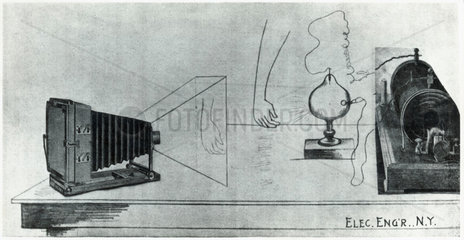 X-ray photography  1896.