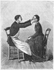 Inducing hypnosis  1881.
