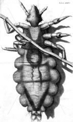 Louse clinging to a human hair  micrograph  1664.