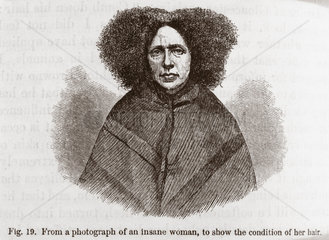 ‘Insane’ woman  1872.