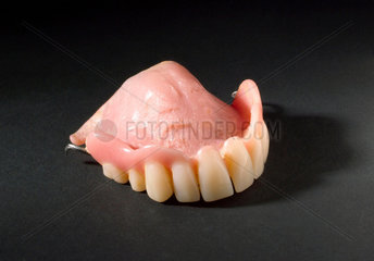 Partial upper denture set  1955-1975.