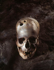Trepanned Bronze Age skull  2200-2000 BC.