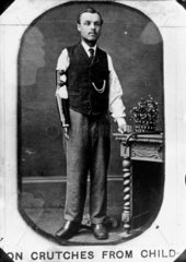 Man wearing an artificial arm  1890-1910.