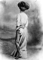 Woman wearing an artificial leg  1890-1910.
