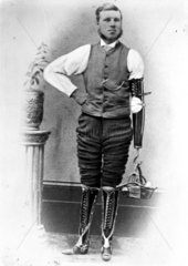 Man wearing two artificial legs and an artificial arm  c 1906.