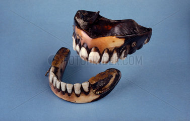 Full upper and lower dentures  1801-1870.