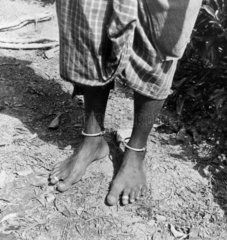 Feet of a tea plantation worker  Ceylon (Sr