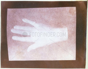 A human hand  c 1841. Salted paper print b