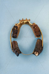 Partial upper and lower denture  1801-1850.