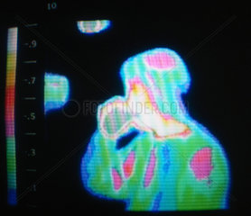 Thermal image of a person drinking  c 1980s.