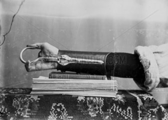Man wearing a prosthetic device for the arms and hand  1890-1910.