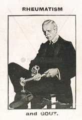 Using the ‘Veedee’ vibratory massager for rheumatism  c 1900-1925.