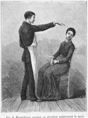 Hypnotism produced by the sudden stretching of the hand  1881.