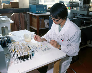 Testing for blood group  1980.