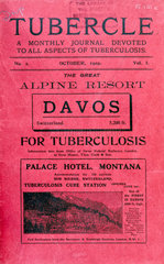 'Tubercle' journal  1919.