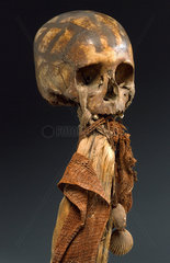 Human skull  Andaman Islands  1871-1920.