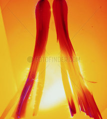 Kirlian photograph of onion legs.