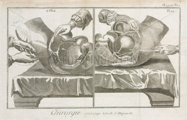Abdominal surgery  1780.