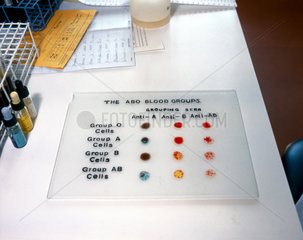 The ABO blood groups  1980.