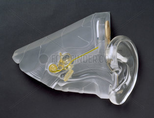 Model showing the positon of a cochlear implant  1999.