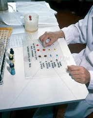 Testing for blood group  1980.