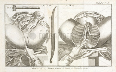 Muscles of the perineum  1780.
