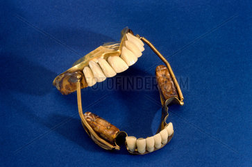 Partial denture set  c 1840-1860.