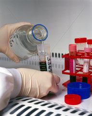 Scientist adding ice-cold water to a blood sample.