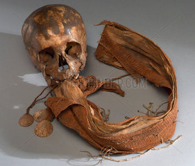 Human skull  Andaman Islands  1871-1920.