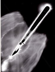 Kirlian photograph of a scalpel.