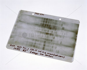 First genetic fingerprint  1984.