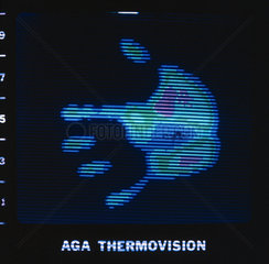 Thermal image of a human hand  c 1980s.