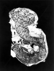 Whole lung section  c 1970.