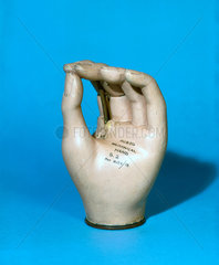 Prosthetic hand  1979-81.