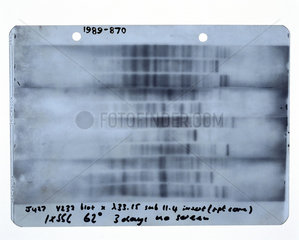 First genetic fingerprint  1984.