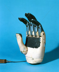 Prosthetic hand with moveable fingers  1979