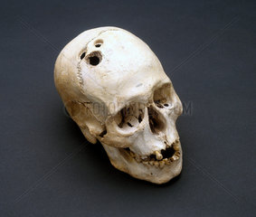 Bronze Age skull  Jericho  Palestine  2200-2000 BC.