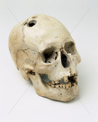Bronze Age trepanned skull  Jericho  Palestine  2200-2000 BC.