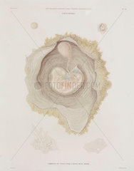 Human embryo  c 1847-1859.
